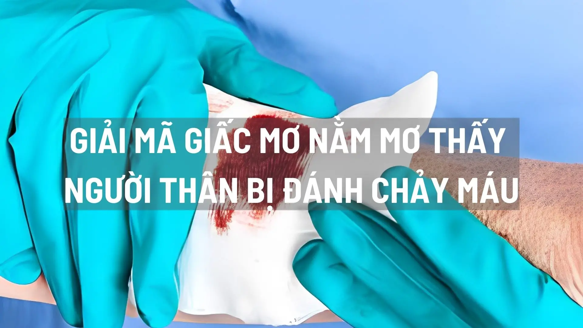 Giải mã giấc mơ nằm mơ thấy người thân bị đánh chảy máu